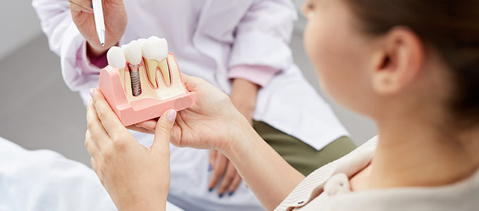 Zahnimplantat für feste Zähne in Langen – Kieferchirurgie beim Facharzt